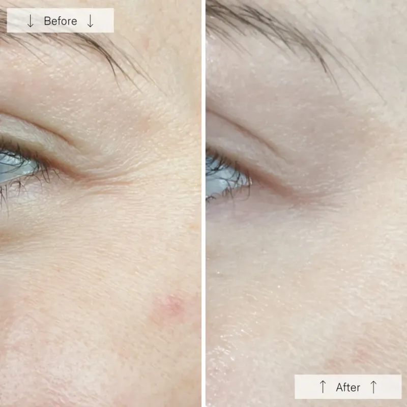 OMNILUX CONTOUR for aldring og inflammasjon